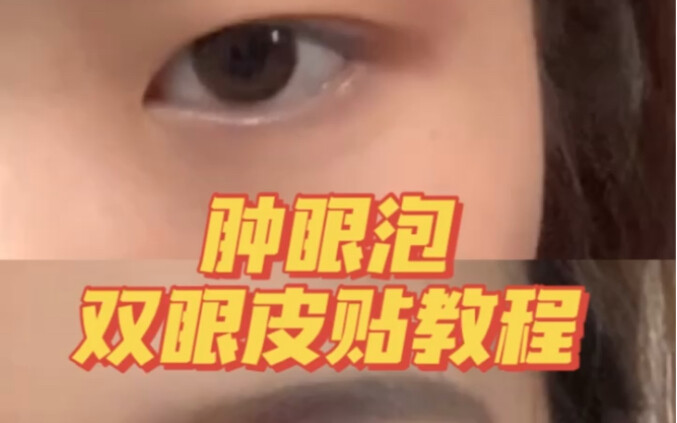 Cách dán miếng dán mí cho mắt sưng húp
