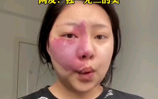 Girl Draws a Map of China on Her Birthmark!