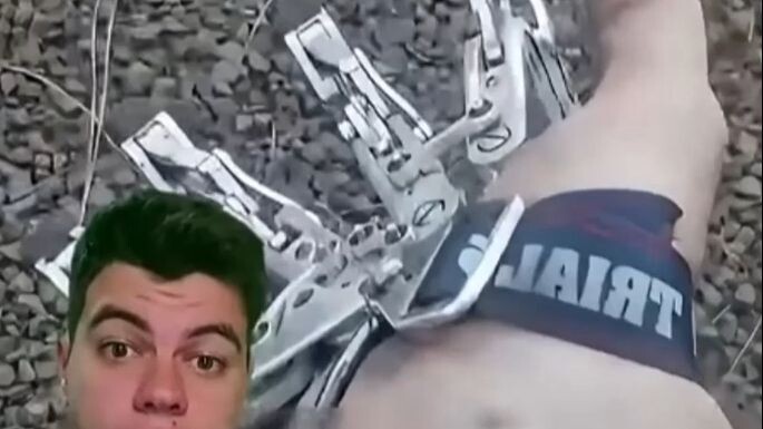 Prótese parcial de mão