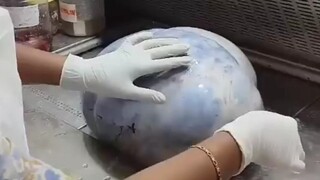 What does a cyst the size of a basketball look like when it's cut open?