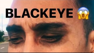 Blackeye.mp4