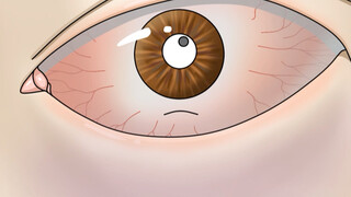 Sharingan? Get it you!