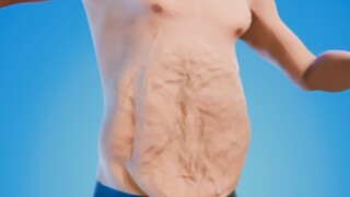 Remove your excess skin.