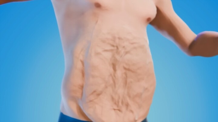 Mengangkat kulit Anda yang berlebih