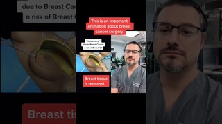 Breast Cancer Surgery #shorts
