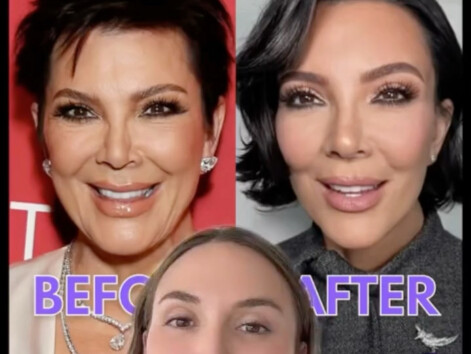 لقد عُثر على الطبيب الذي أعاد الجمال إلى الإمبراطورة الأم! لكن الأمر يتطلب 350 ألف دولار أمريكي...