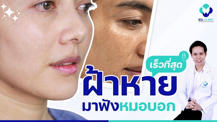 "ฝ้า" หายเร็วที่สุด มาฟังหมอบอก | รักษาฝ้า