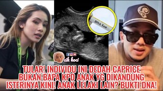 Tular! Individu Ini Dedah Caprice Bukan Bapa Kpd Anak Yg Dikandung Isterinya Kini! Anak Lelaki Lain?