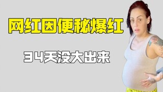 34 ngày không đi đại tiện, hotgirl nổi tiếng nhờ táo bón