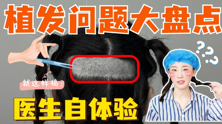 Semua yang ingin kamu tanyakan tentang transplantasi rambut ada di sini!