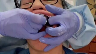 A medical student introduces how to make a "dental impression" tool