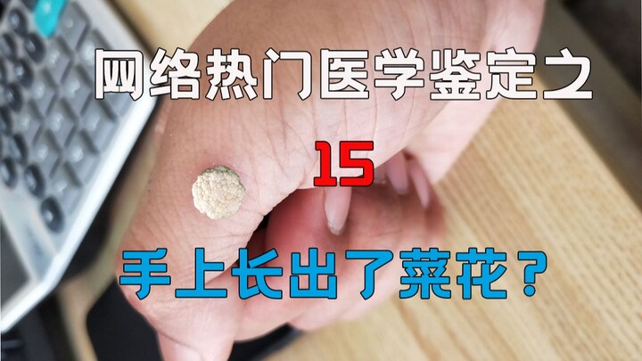 [การตรวจสอบทางการแพทย์] การตรวจสอบวิดีโอทางการแพทย์ยอดนิยมบนอินเทอร์เน็ต 15