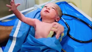 أصاب الطفل بالذعر: يقوم الطبيب بإجراء "اختبار الانعكاسات" للمواليد الجدد لفحص ما إذا كان الجهاز العص