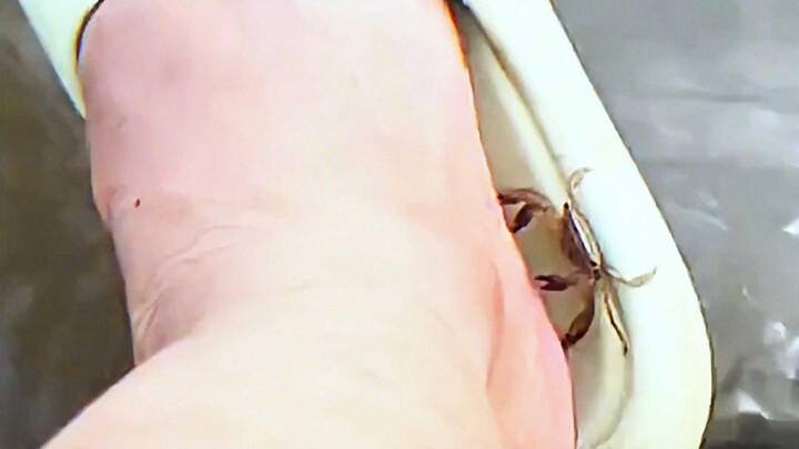 Enjoy service from the Crab Technician