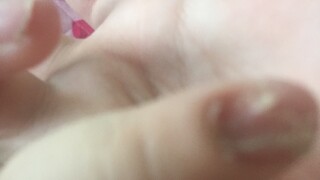 37