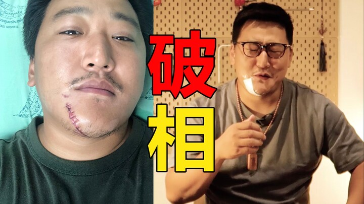 The Gengzi Year No One Can Escape! Brother Zhuang’s Car Crash Left Him Disfigured—Let’s Talk About K