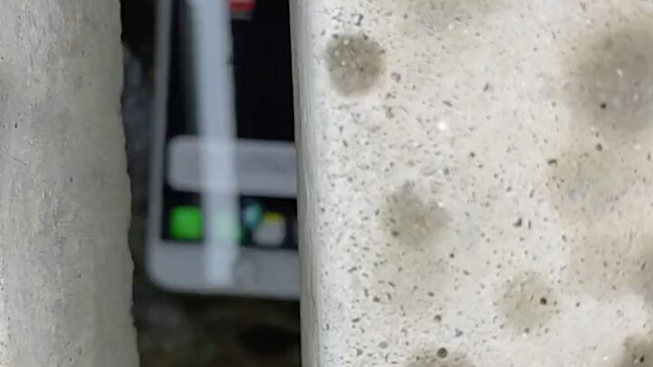 My kidney fell down the drain...