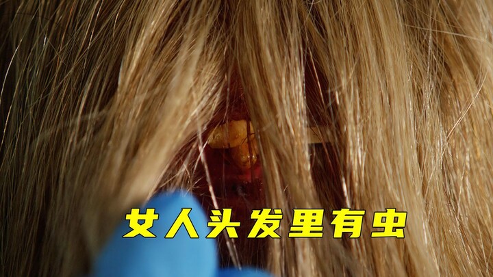 Woman’s intimate area has an accident—creepy worms actually start growing inside!