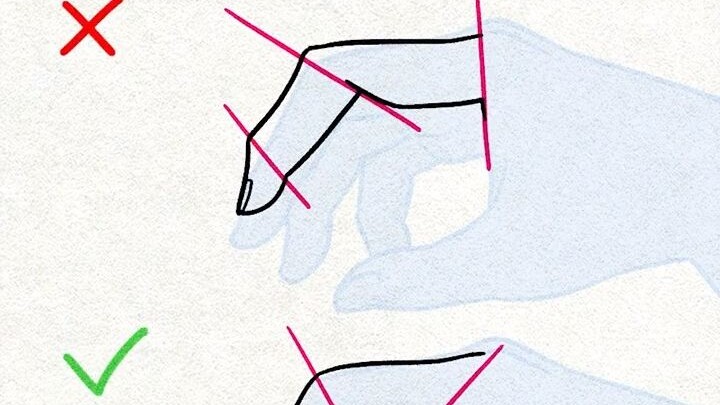 【Kawaiisensei】The 3 Most Important Lines for Your Finger Joints?