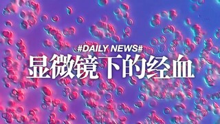 Darah haid di bawah mikroskop