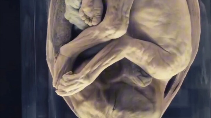 This is probably the youngest body donor.