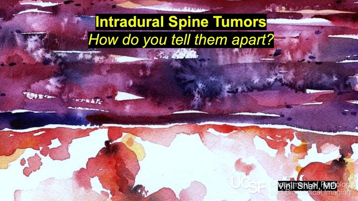 Intradural Spine Tumors - How to Tell Them Apart
