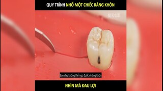 Nhổ một chiệc Răng Khôn đau đến mức nào | LT Review