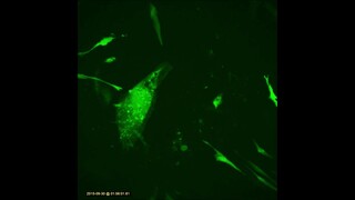 Time Lapse of Adipose Stem Cells after Electroporation