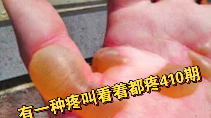 هناك نوع من الألم يجعلك تتألم لمجرد النظر إليه 410