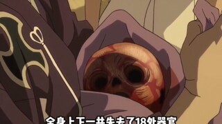 男孩生下来就全身上下失去了18处器官，他的父亲不但不伤心，反而开怀大笑！