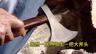 这开颅手术我也不敢