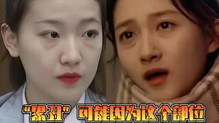 “累丑”可能因为这个部位