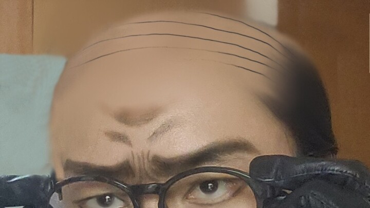 Tôi bị hói nhưng tôi cũng đã thay đổi!