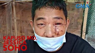 Kapuso mo, Jessica Soho: Lalaki sa Bukidnon, Tinusok sa Mata at Tinangka ring Sipsipin ang Dugo?