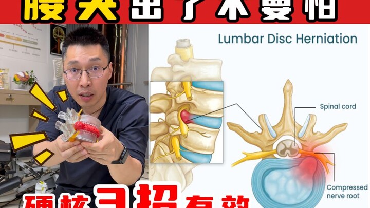 【奥运冠军的脊医博士后】腰突出了不要怕 硬核3招有效