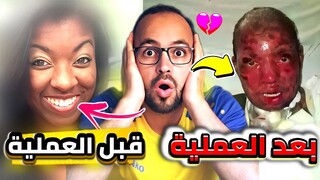 أخطاء طبية انتهت بكوارث خطيرة‼️لن تثق في الأطباء بعد اليوم✖️