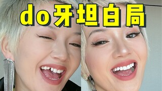 Menghabiskan enam digit untuk memperbaiki gigi, ternyata saya malah menyesal?