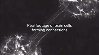 NAKAKAMANGHA! Brain cells under microscope.