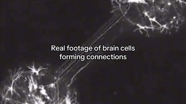 NAKAKAMANGHA! Brain cells under microscope.