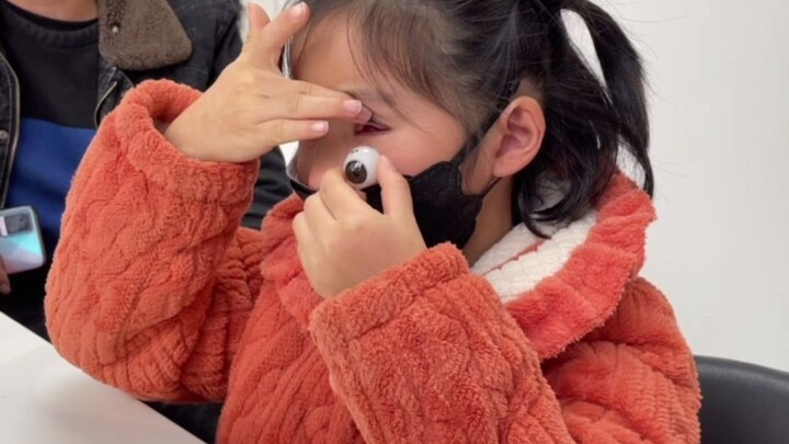 7-year-old girl has been wearing a prosthetic eye for 3 years.