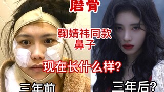 จมูกของจูจิงอี้ในอีก 3 ปีข้างหน้าจะเป็นอย่างไร? เพราะความมั่นใจที่มาจากความงาม