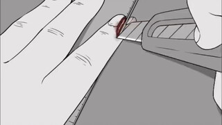 It hurts! It really hurts.