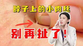 Don't pull the little fleshy silk on your neck! Be careful or it will grow bigger!