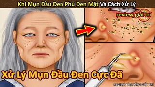 Nhím Cute Review mụn đầu đen phủ kín mặt và cách xử lý || Review Giải Trí Đời Sống