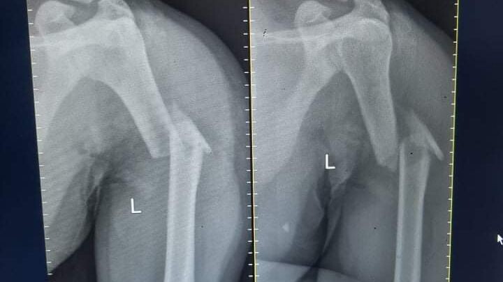 2nd life Motor accident .. Thank you lord