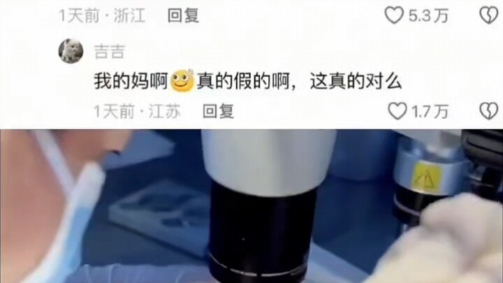 Ectopic Foster Replantation Surgery #This “Bro” Stole the Show—Netizens: That Two-Step Walk Is Somet