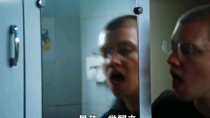 A man was bitten by a wolf. When he woke up, he found hair growing in his eyes!