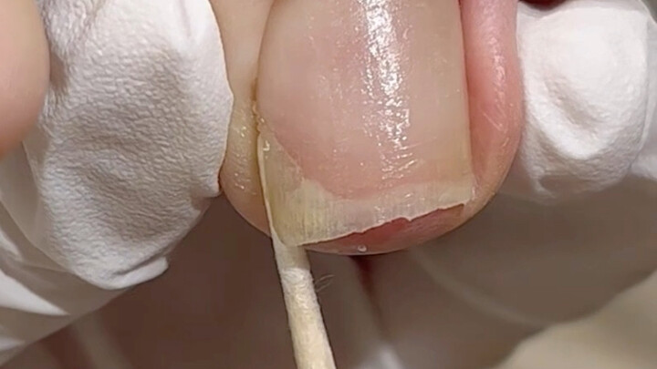 Không được cuộn