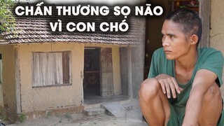 Thanh Niên Bị Chấn Thương Sọ Não Vì Né Con Chó Ven Đường, Hộp Sọ Còn Một Nữa