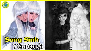 10 Cặp Song Sinh Kỳ Lạ Và Quái Dị Nhất Thế Giới Khiến Mọi Người Không Tin Họ Tồn Tại